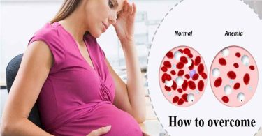 pregnancy iron deficiency. pregnancy anemia, low hb